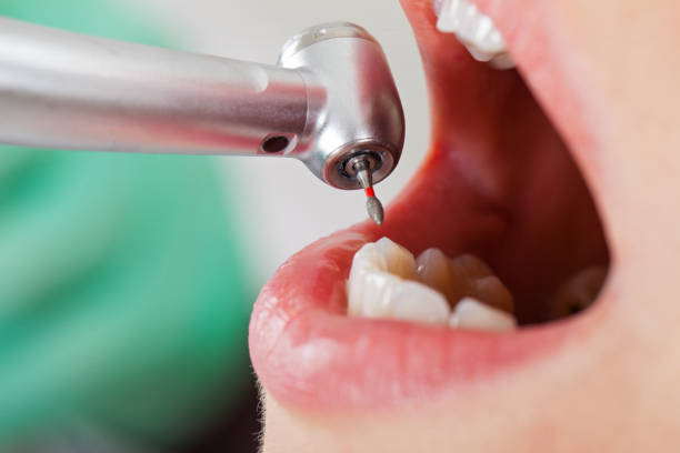 Best Pediatric Emergency Dentist in Deer Park, WA